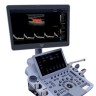 УЗИ аппарат Edan Acclarix LX9 - 2 242 151 руб.
