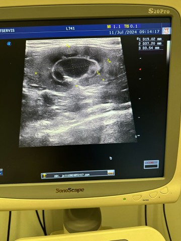 УЗИ аппарат Sonoscape S20 Pro, 2017 г.в. - 700 700 руб.