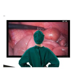 Монитор медицинский UHD 4K Steinmann 8155, 55"