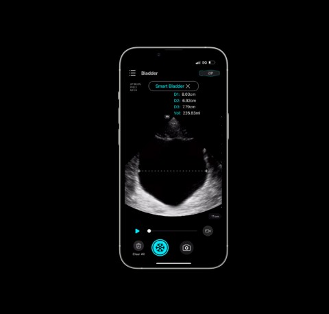 УЗИ сканер Mindray TE Air i3P - 329 800 руб.